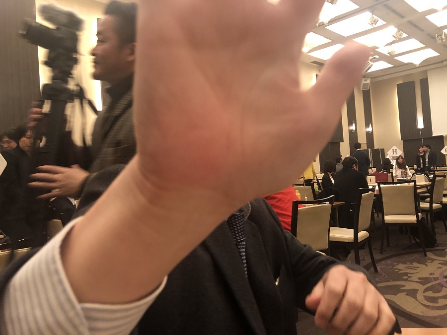 手